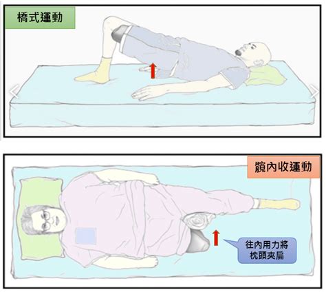 截刀臥位|痔瘡的治療原則與方法